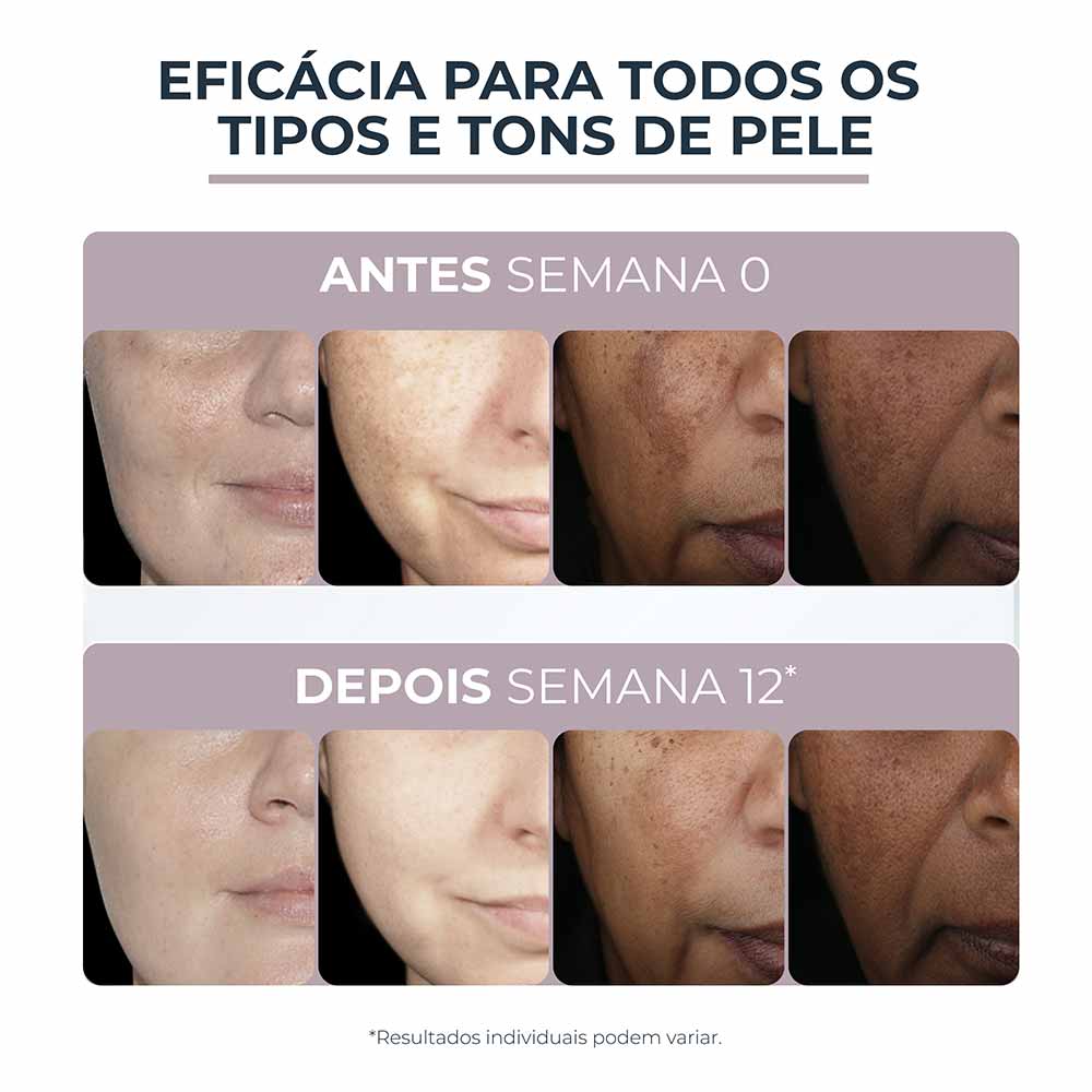 Creme Facial Eucerin Anti-Pigment Noite